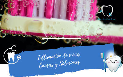 Inflamación de encías