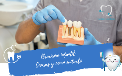 Cuidados necesarios tras un implante dental