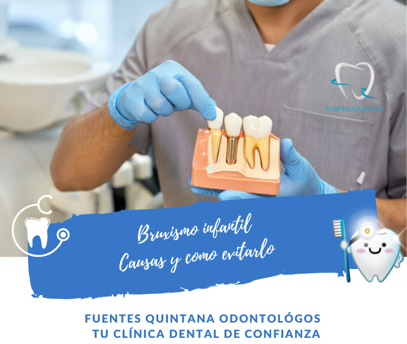 Cuidados necesarios tras un implante dental