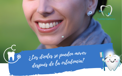 ¿Los dientes se pueden mover después de la ortodoncia?