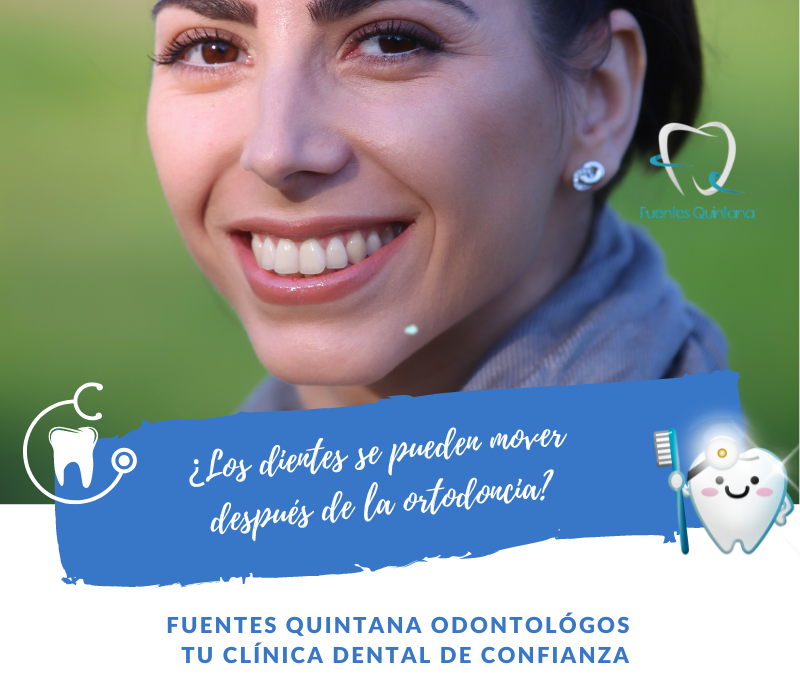 ¿Los dientes se pueden mover después de la ortodoncia - Clinica dental Fuentes Quintana Guadalajara