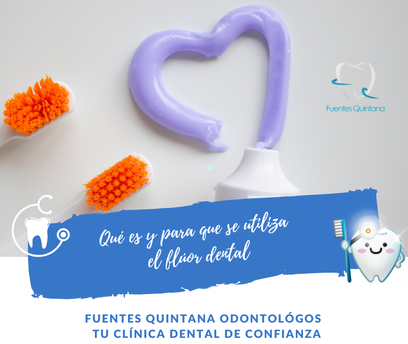 Qué es y para que se utiliza el flúor dental