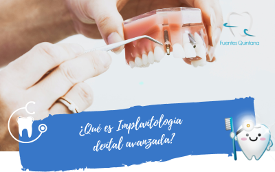 Qué es Implantología dental avanzada