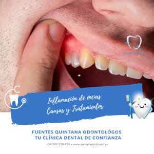 Por qué se inflaman las encías - clínica dental Guadalajara Fuentes Quintana