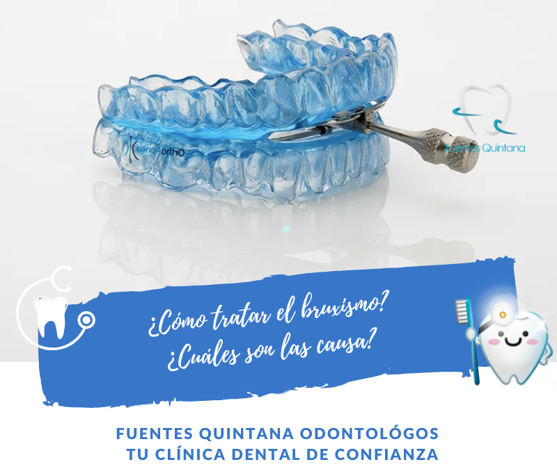 Cómo tratar el bruxismo