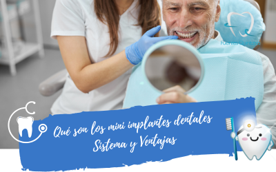 Qué son los mini implantes dentales