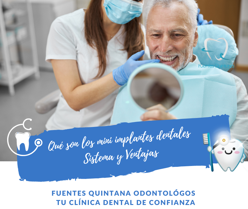 mini implantes dentales- Clinica dental Fuentes Quintana Guadalajara
