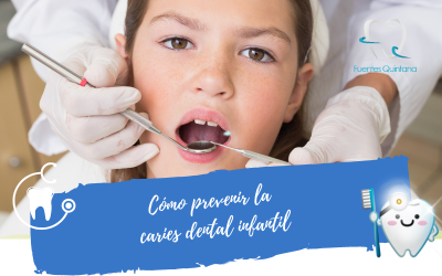 Cómo prevenir la caries dental infantil