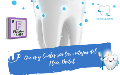 Cuáles son las ventajas del flúor dental