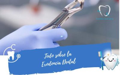 Todo sobre la exodoncia dental