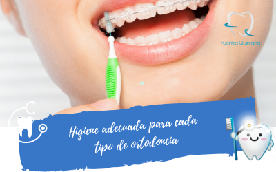 Higiene adecuada para cada tipo de ortodoncia
