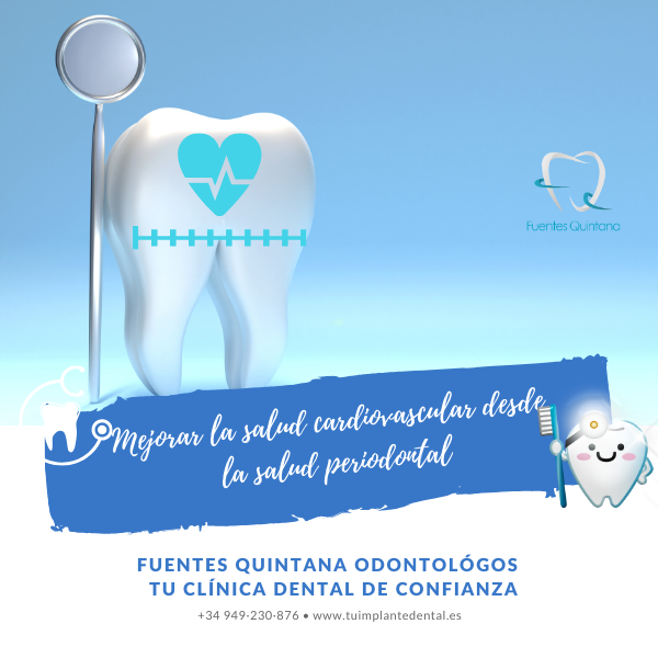 Mejorar la salud cardiovascular desde la salud periodontal Una sonrisa saludable para un corazon fuerte - Clinica dental Fuentes Quintana Guadalajara
