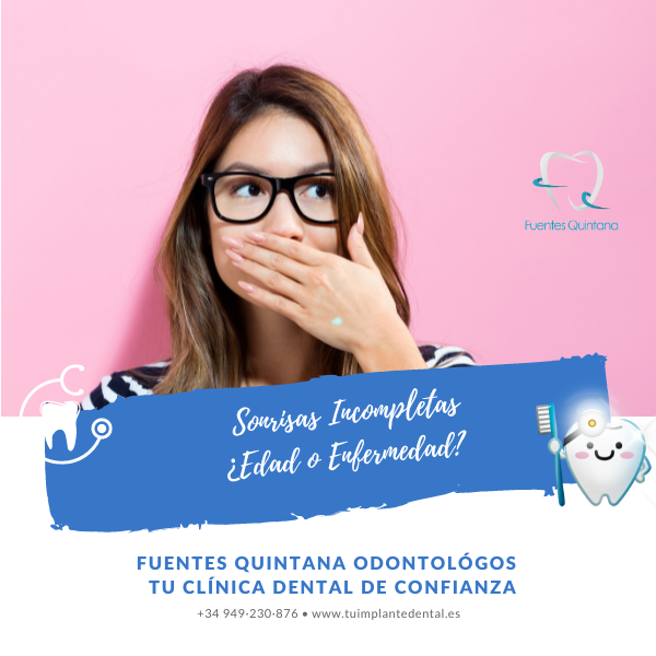 Sonrisas Incompletas: ¿Edad o Enfermedad? - Clínica dental en Guadalajara Fuentes Quintana Odontólogos