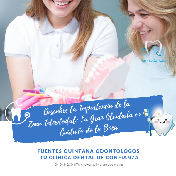 Descubre la Importancia de la Zona Interdental La Gran Olvidada en el Cuidado de la Boca - Clinica dental Fuentes Quintana Guadalajara