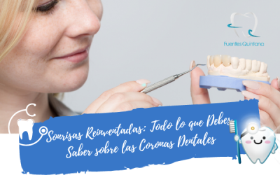 Todo lo que Debes Saber sobre las Coronas Dentales