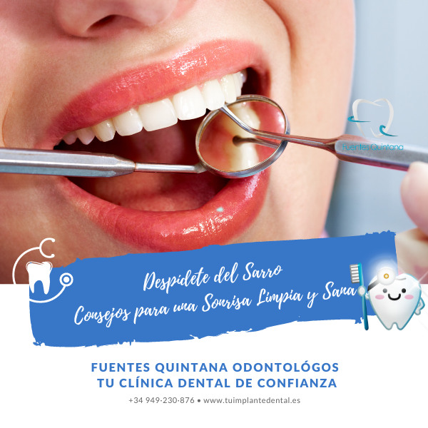 Despídete del Sarro Consejos para una Sonrisa Limpia y Saludable