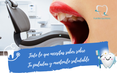 Todo lo que necesitas saber sobre el paladar