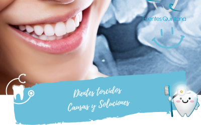 Dientes Torcidos : Causas, Soluciones y Cómo Podemos Ayudarte