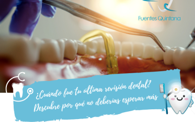 ¿Cuándo fue tu última revisión dental?