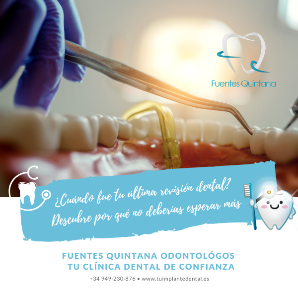 sesión dental - clinica dental Fuentes quintana Guadalajara