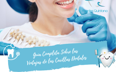 Guía Completa Sobre las Ventajas de las Carillas Dentales