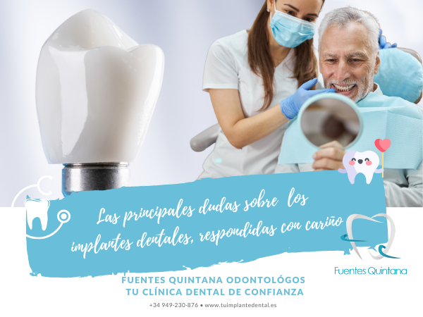 dudas sobre los implantes dentales Clinica dental Fuentes Quintana Guadalajara 800x600 (1)