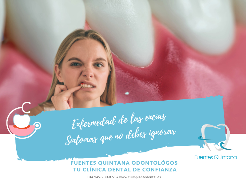 Enfermedad de las encías