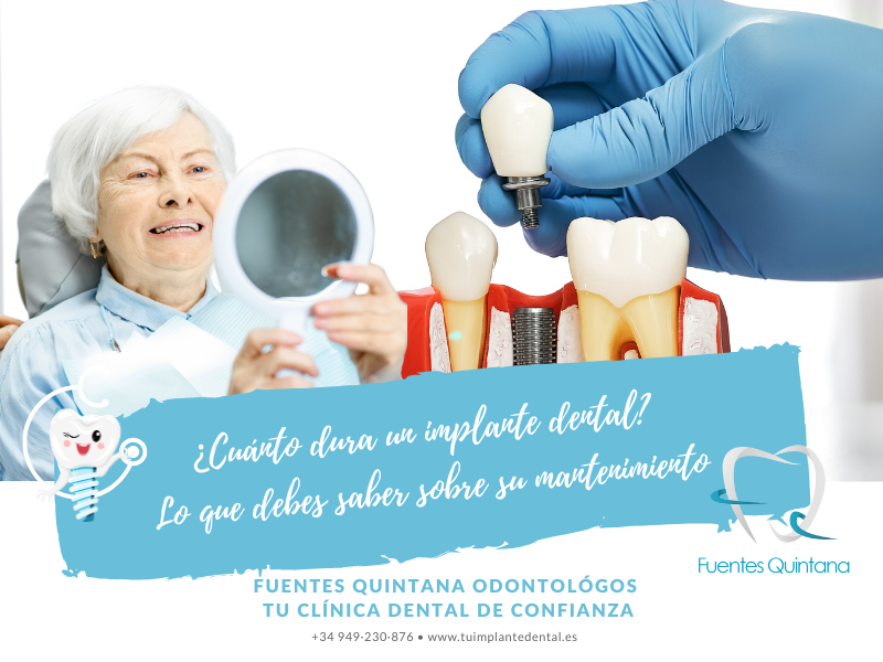 ¿Cuánto dura un implante dental? - Lo que debes saber para mantenerlo - Clinica dental Fuentes Quintana Guadalajara