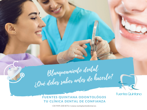 Blanqueamiento dental ¿Qué debes saber antes de hacerlo?