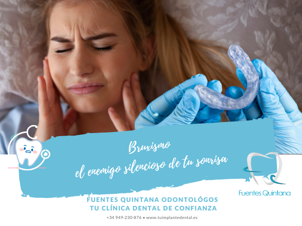 Bruxismo El enemigo silencioso de tu sonrisa