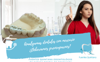 Amalgamas dentales con mercurio