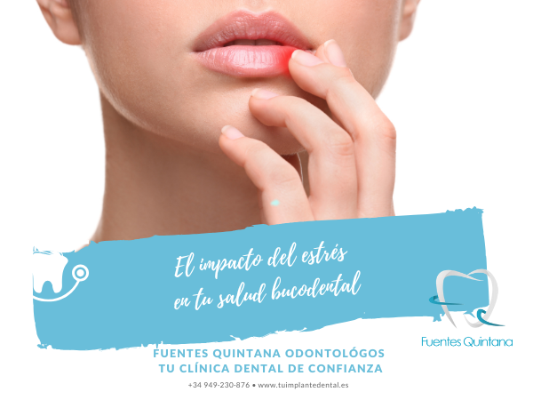 El impacto del estrés en tu salud bucodental - Tu implante dental - Clínica dental Fuentes Quintana Guadalajara