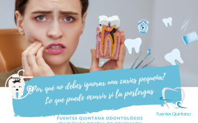 ¿Por qué no debes ignorar una pequeña caries dental?