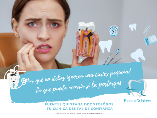 pequeña caries dental - ¿Por qué no debes ignorar una caries pequeña? Lo que puede ocurrir si la postergas - www.tuimplantedental.es