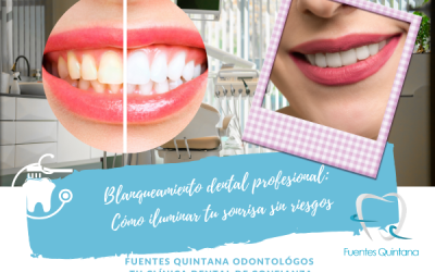 Blanqueamiento dental profesional en Guadalajara