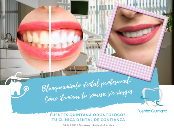 Paciente feliz mostrando su sonrisa blanca después de blanqueamiento dental profesional en TuImplanteDental