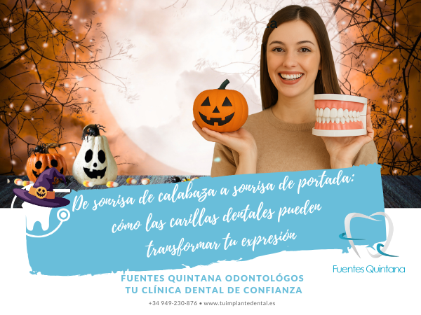 Carillas dentales en Guadalajara