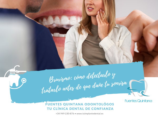 Cómo detectar y tratar el bruxismo en Guadalajara