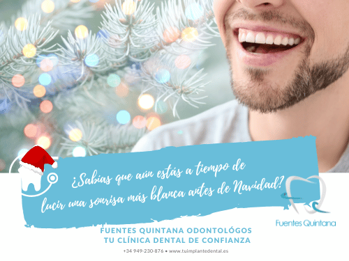 Blanqueamiento dental en Guadalajara