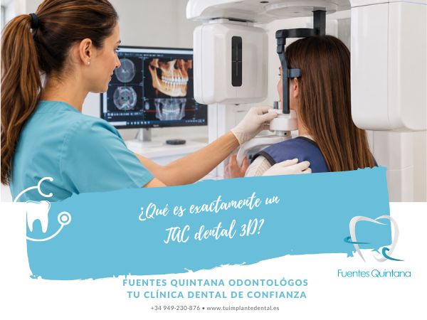 TAC dental 3D en Clínica Dental Fuentes Quintana